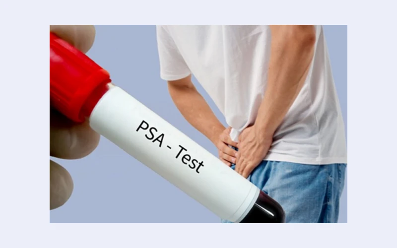 PSA Test for Prostate Cancer in London